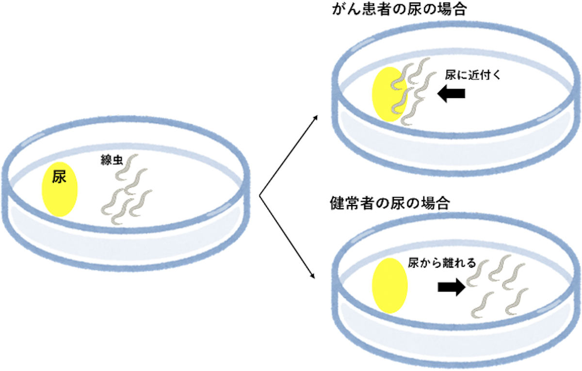 膵がん