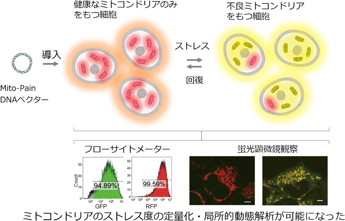 パーキンソン病