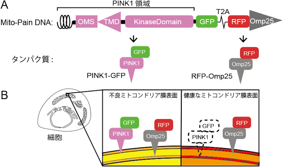 パーキンソン病