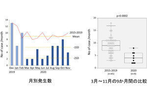 新型コロナの感染予防対策の徹底で川崎病の患者数が減少、山梨大が確認