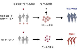 新型コロナの重症化を防ぐT細胞、阪大が同定に成功