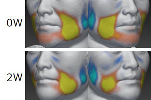 資生堂、数値で表すことが難しかった「たるみ」を定量的に示す評価法を開発
