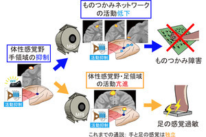 手と足の感覚は脳内でつながっている、量研などが発見