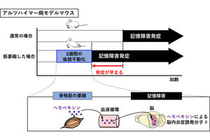 身体活動の低下が認知機能の低下を招くことを富山大がマウスで確認