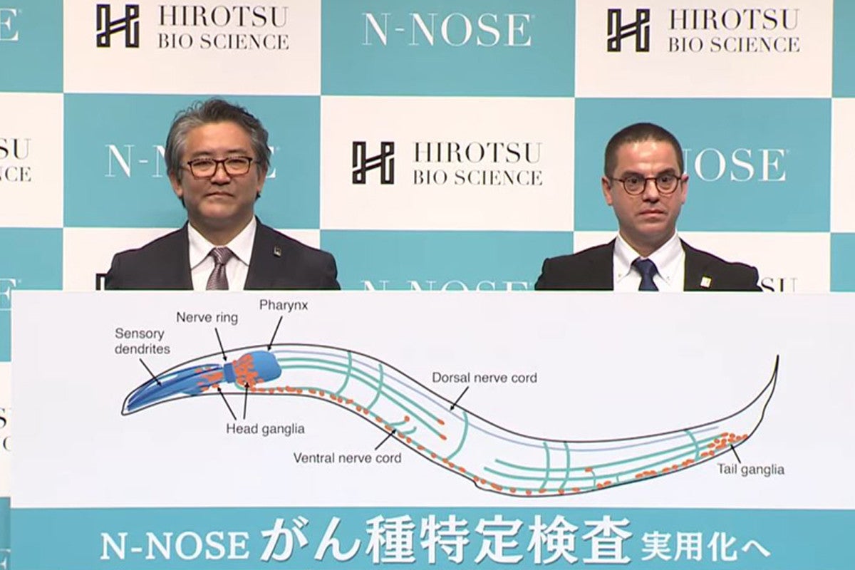 線虫を用いて早期すい臓がんの特定に成功、2022年の実用化目指す