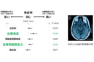 花王と弘前大、65歳以上において内臓脂肪と認知機能が関係している事を確認