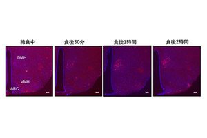 北大、視床下部に食欲を抑える働きがある神経細胞を発見