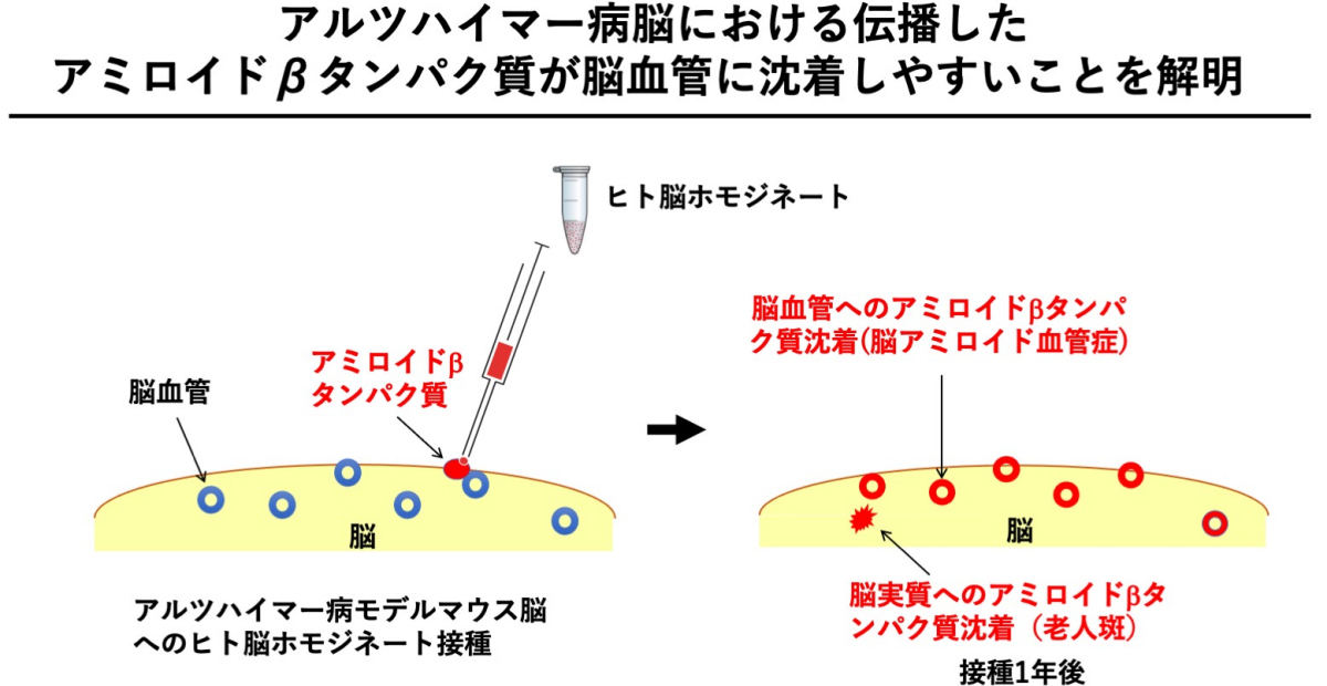 脳科学