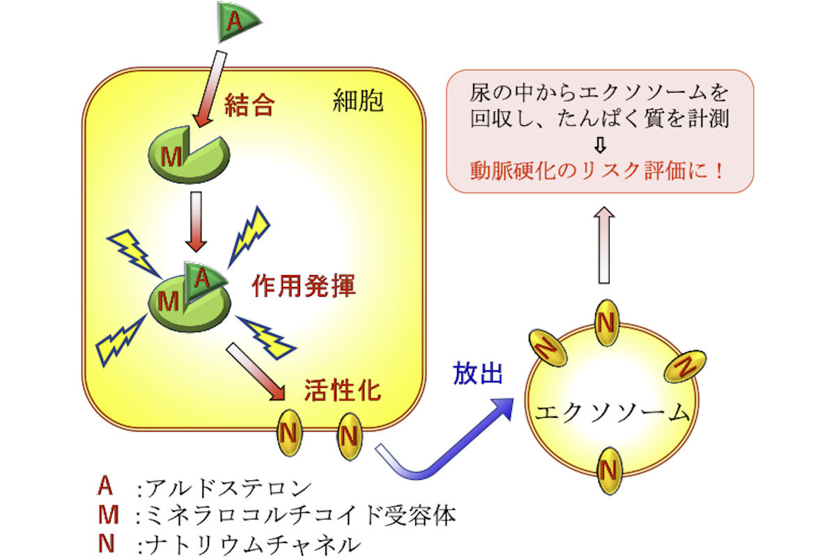 動脈硬化