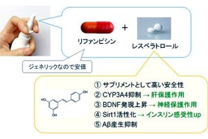 既存薬を組み合わせた点鼻薬に認知症予防の可能性、大阪市立大が効果を確認