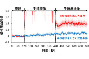 整骨院などの「手技療法」、肩こりの改善に効果があることを明大が確認