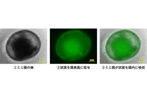 DNP、ヒトiPS細胞で作った「ミニ腸」による三大栄養素の吸収を確認