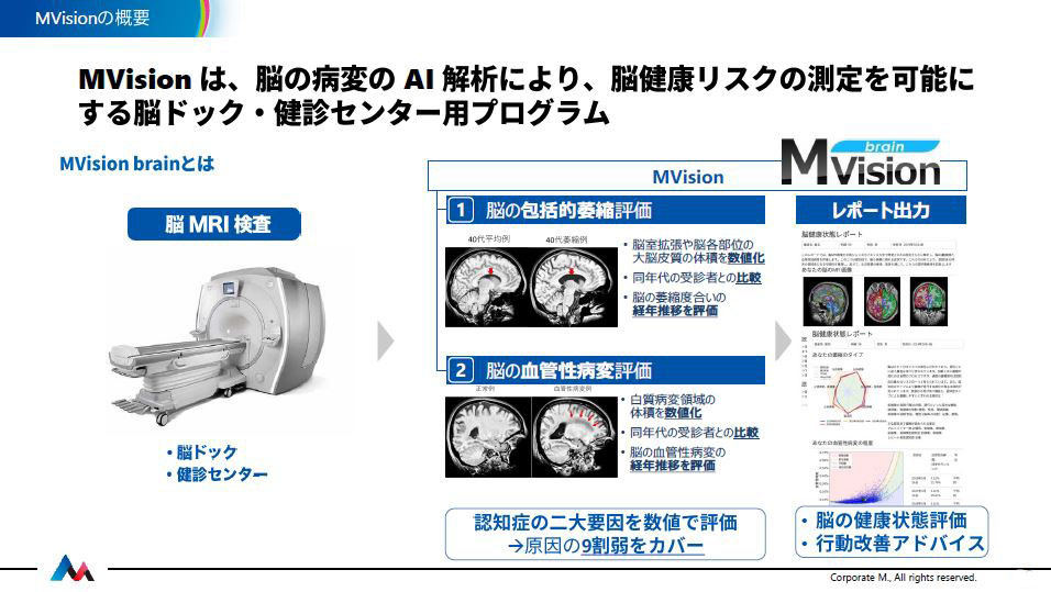 MVision brainの概要