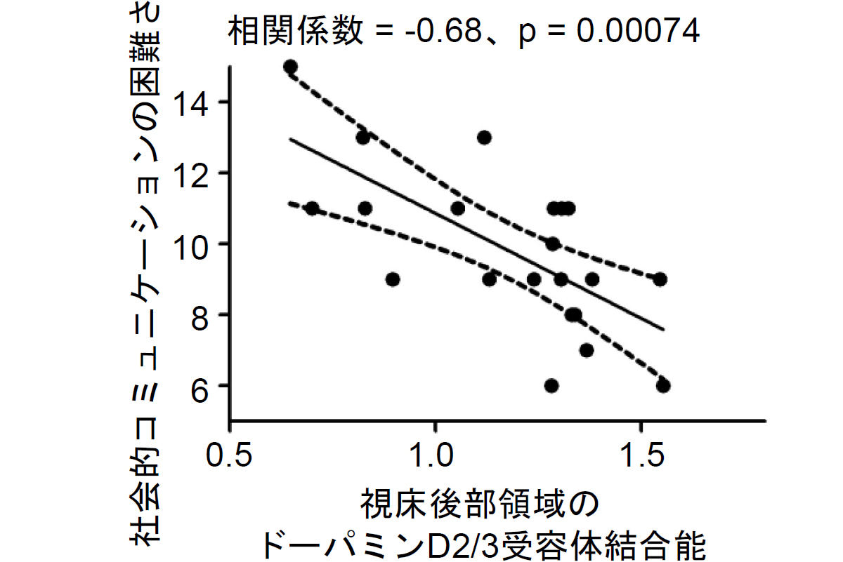 自閉スペクトラム症