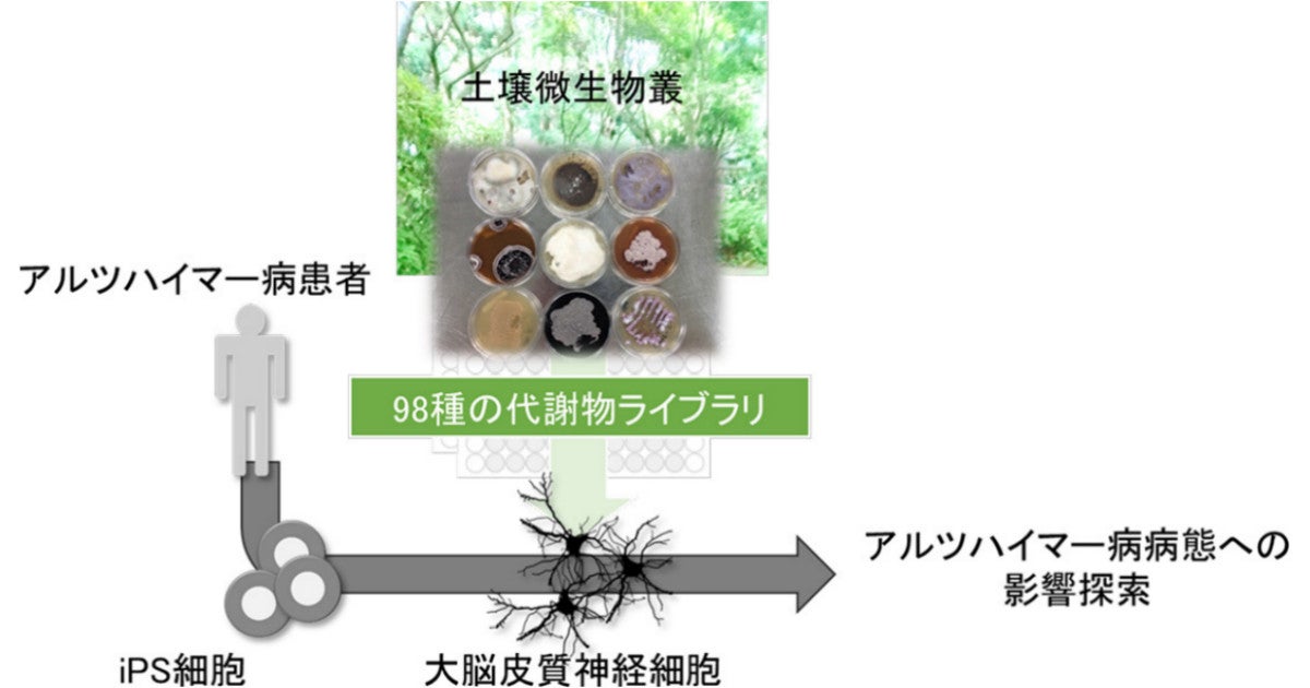 土壌の微生物がアルツハイマー病の病態に影響する可能性 京大などが確認 Tech