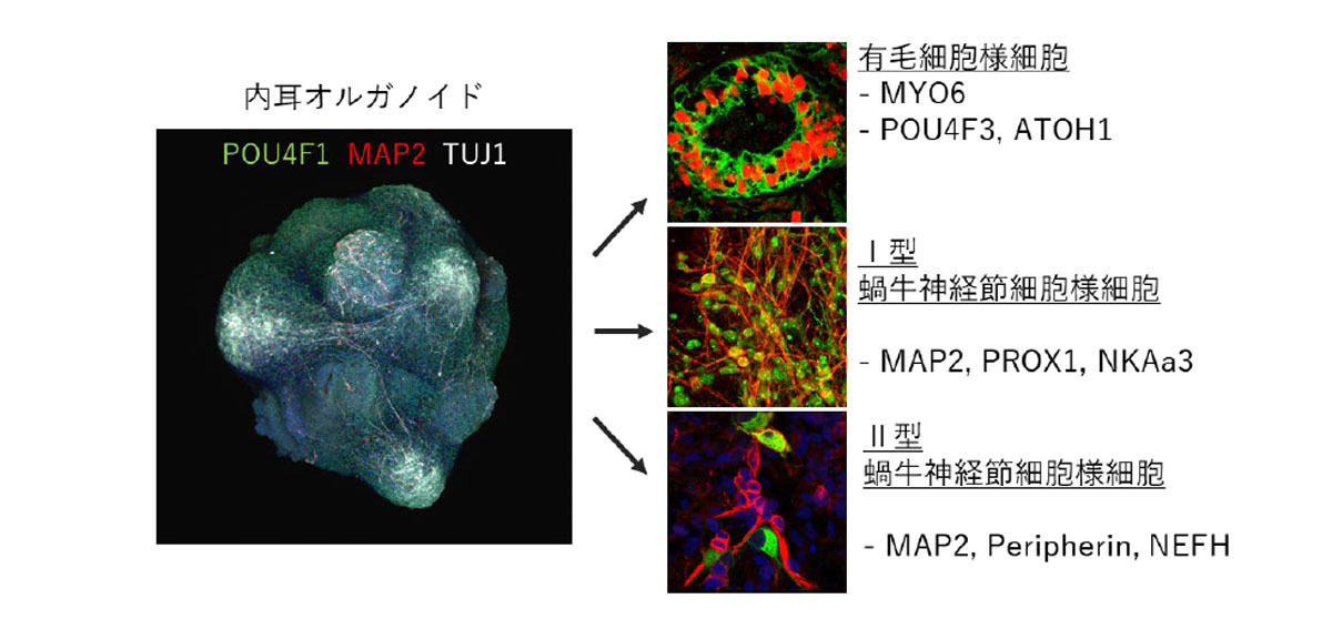 内耳オルガノイドの構成細胞