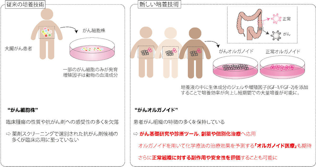 大腸がんに対する患者由来オルガノイド