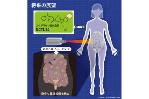 大阪市立大、近赤外線レーザーの照射で卵巣がん細胞を可視化できる蛍光色素を開発