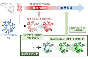 慢性疼痛の痛みを自然に和らげていく細胞、九大などが発見