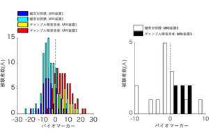 脳機能画像を基にしたギャンブル障害の診断用判別器、医科歯科大などが開発