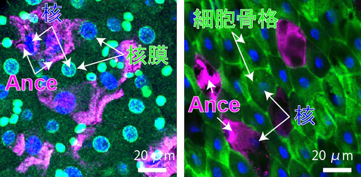 Ance発現細胞の核には、核膜が存在していない