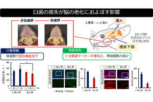 奥歯の喪失で脳の老化が促進される、 長寿医療研究センターがマウスで確認