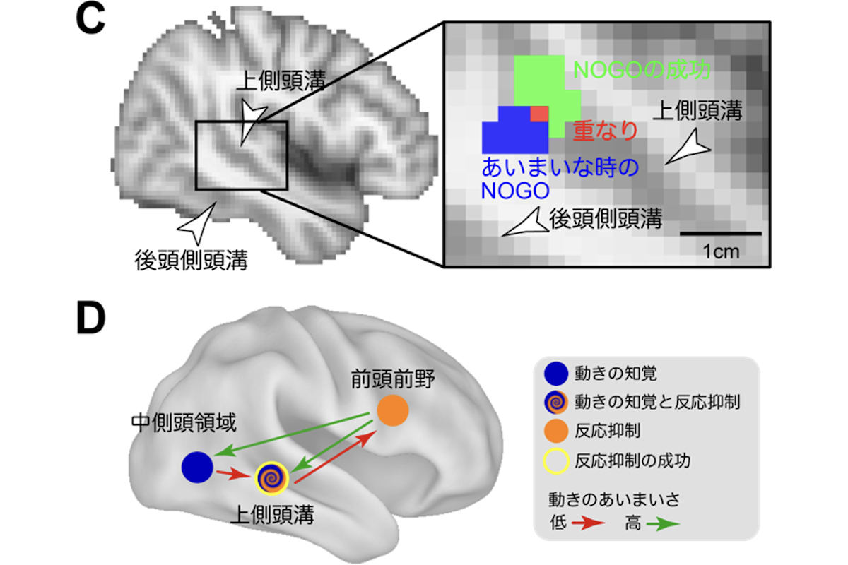 「知覚の曖昧さに伴う反応抑制の難しさの上昇」には、上側頭溝が関連していることが同定された