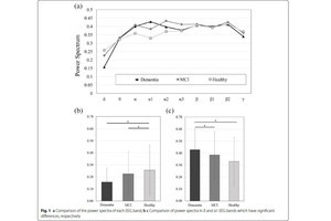 小型の簡易脳波計で軽度認知障害の特徴を検出することに慶大が成功