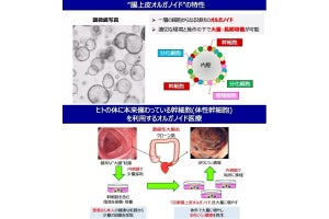 東京医科歯科大、潰瘍性大腸炎の難治性潰瘍の修復を目指したミニ臓器移植を実施