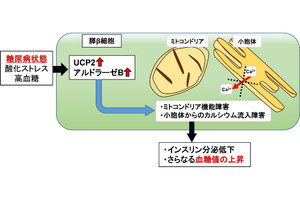 群馬大、糖尿病で膵β細胞からインスリン分泌が低下する新たな原因を解明