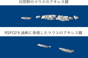 東大、「プロジェニター細胞」が腱・靱帯に分化する仕組みの一部を解明