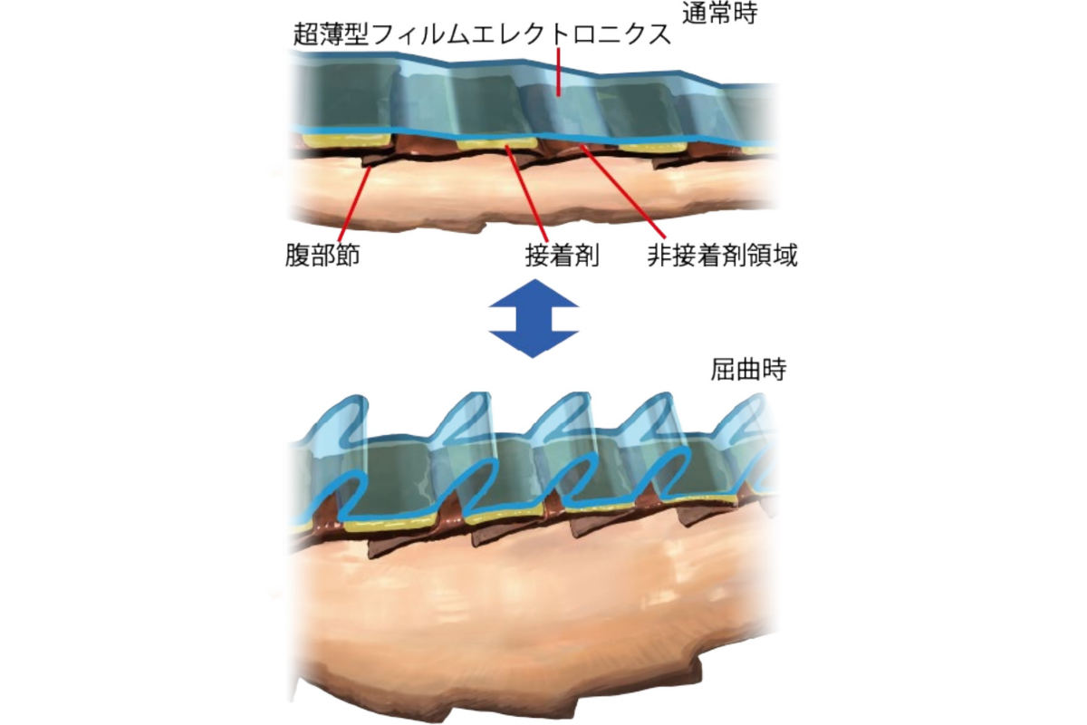 超薄型有機太陽電池の腹部実装の概要図