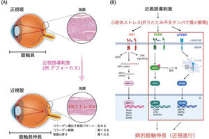 慶大、近視を点眼で治療できる可能性のある化合物をマウスによる実験で発見