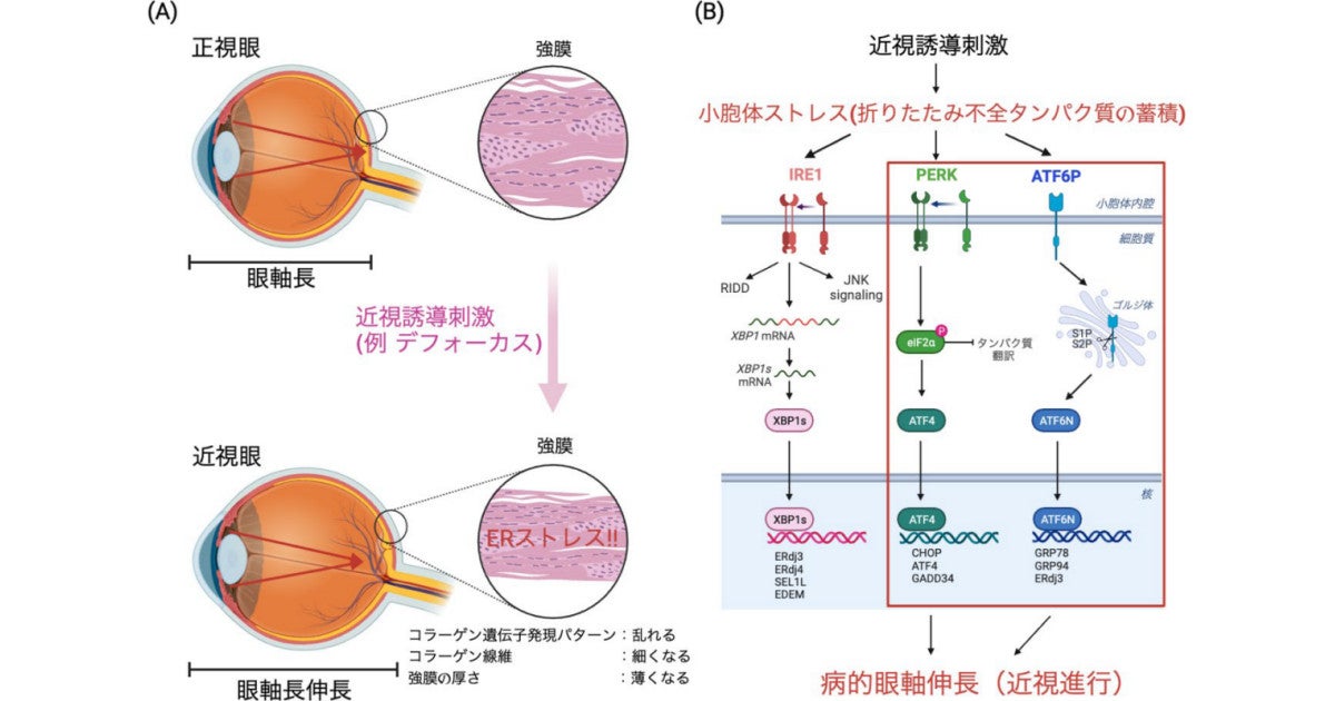 慶大、近視を点眼で治療できる可能性のある化合物をマウスによる実験で発見 (1)