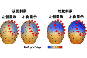 東工大、空間への注意に対する右脳優位性に脳部位「島皮質」の関連を発見
