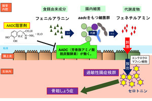 腸内細菌により骨粗しょう症や過敏性腸症候群が発症する可能性、近大など