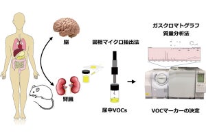 高齢者のうつ・不安症を検出する尿中の新規バイオマーカー、京都産業大が発見