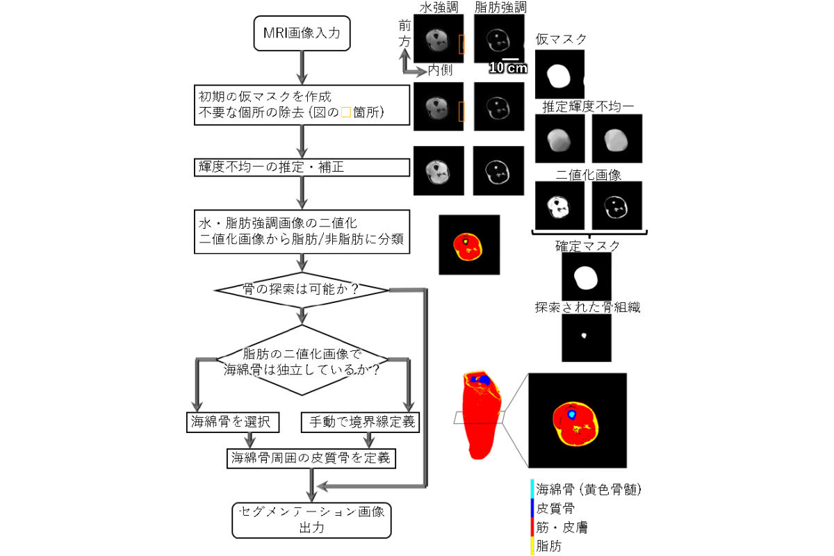 MRI画像解析のフローチャート