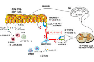 アトピー性皮膚炎の痒みの原因が判明、治療薬の効果を動物実験で確認　富山大など