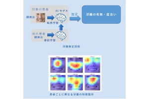 NECと筑波大学、浮腫の有無・度合いを推定するAI技術を開発