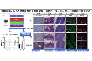 マイクロプラスチックは高脂肪食下で異常を誘発　京都府立医科大などが確認