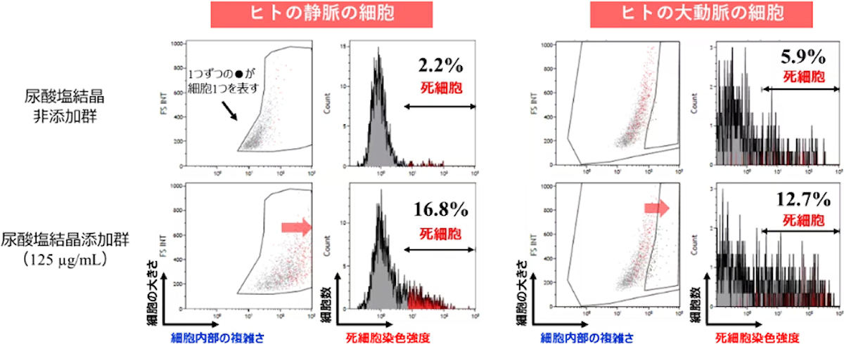 2種類の血管の内皮細胞への尿酸塩結晶添加におけるフローサイトメーターを用いた解析結果