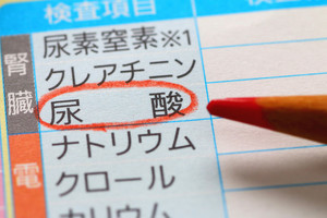 明治、尿酸値が高いと血管の細胞死が誘発される可能性があることを発見