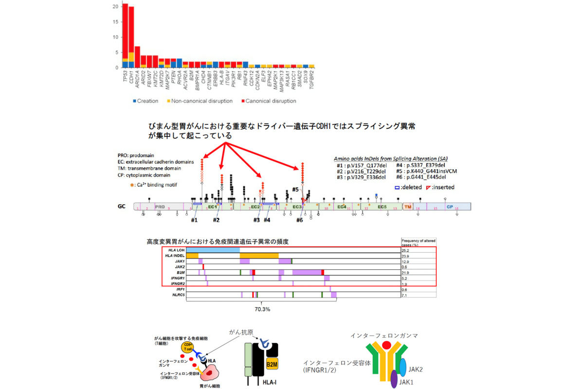 (上から1段目と2段目)胃がんにおけるスプライシング異常の全体像。(上から3段目と4段目)高度変異胃がんにおける免疫関連遺伝子異常の頻度。(3段目)がん抗原の提示(HLA)やがん免疫反応(IFNG/JAK)に重要な遺伝子の異常が高度変異胃がんの約70%の症例で見られた(水色:コピー数欠失、オレンジ:フレームシフト変異、紫:ミスセンス変異、緑:ナンセンス変異、赤:スプライシング異常)。(4段目)胃がん細胞における免疫応答。抗原提示とIFN-γとその受容体の構造模式