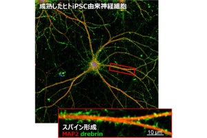 東大など、ヒトiPSC由来神経細胞から3か月で樹状突起スパインを形成する手法を開発
