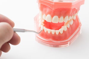日常生活のストレスと口腔の健康状態が持つ関係を東京医科歯科大が発見