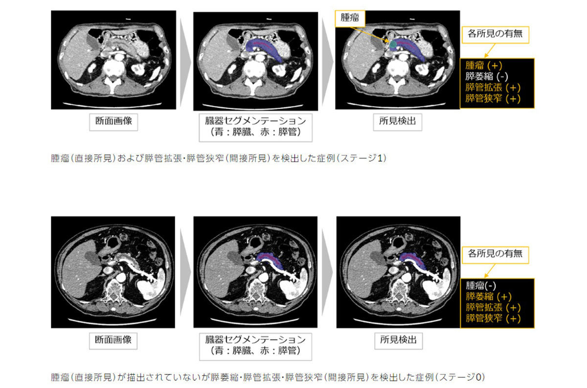 開発した技術を用いて検出した症例