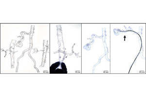 北大、3Dプリンタでの生体血管に類似した血管模型の作製に成功