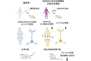 東京医科歯科大、統合失調症患者の一部にシナプス分子の自己抗体を発見