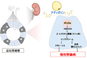 名大、脂肪組織由来のアディポリンの慢性腎臓病に対する防御作用を解明